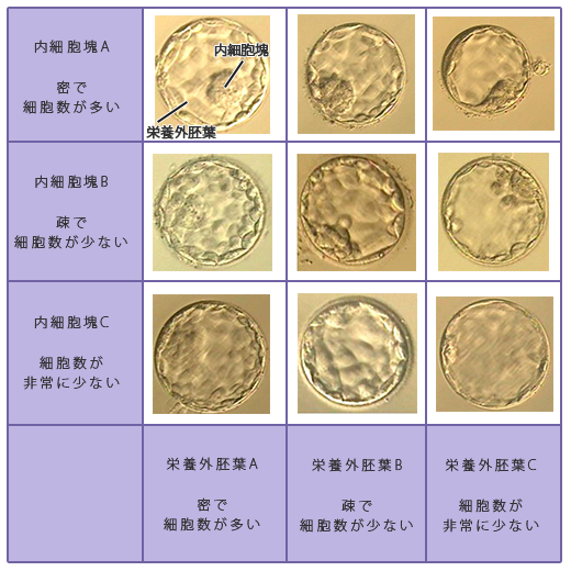 体外受精 顕微授精 不妊治療 体外受精のご相談は自由が丘 陣内ウィメンズクリニック 当婦人科で妊活をフルサポート