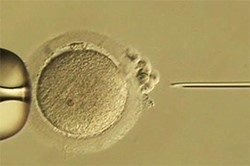 従来の顕微受精